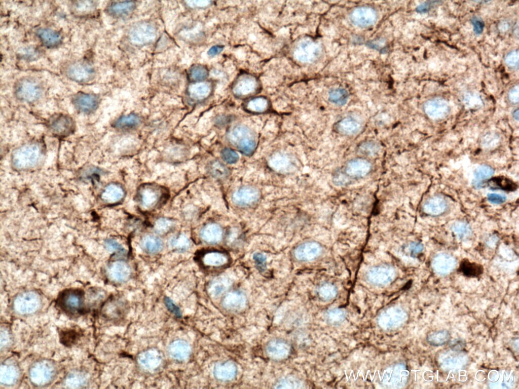 IHC staining of mouse brain using 18934-1-AP