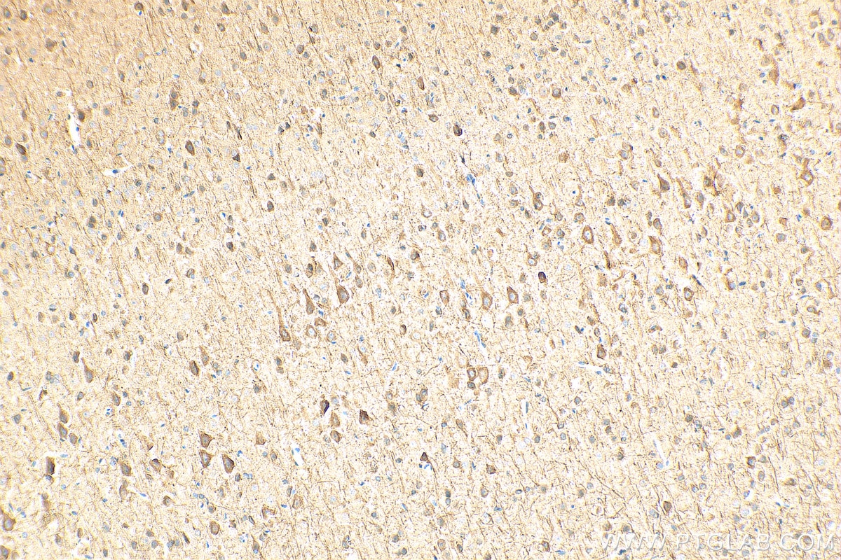 Immunohistochemistry (IHC) staining of rat brain tissue using NF-H/NF200 Polyclonal antibody (18934-1-AP)