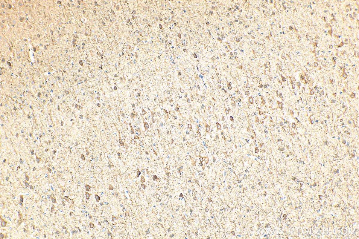 IHC staining of rat brain using 18934-1-AP