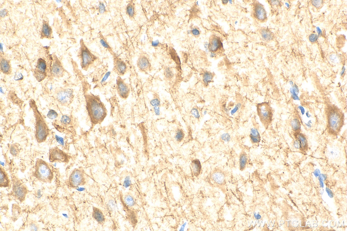 IHC staining of rat brain using 18934-1-AP