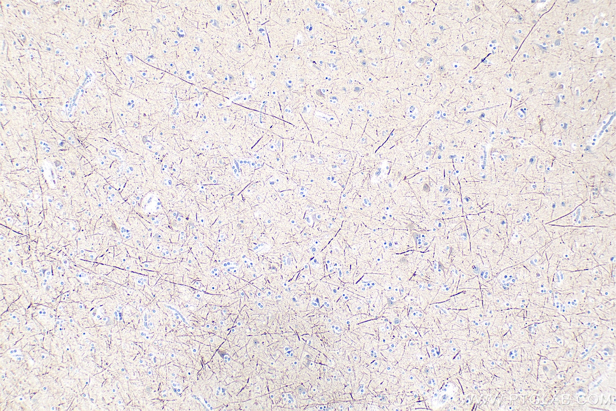 Immunohistochemistry (IHC) staining of human brain tissue using NF-H/NF200 Polyclonal antibody (18934-1-AP)