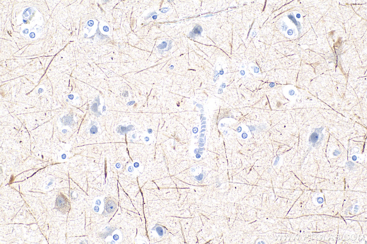 Immunohistochemistry (IHC) staining of human brain tissue using NF-H/NF200 Polyclonal antibody (18934-1-AP)