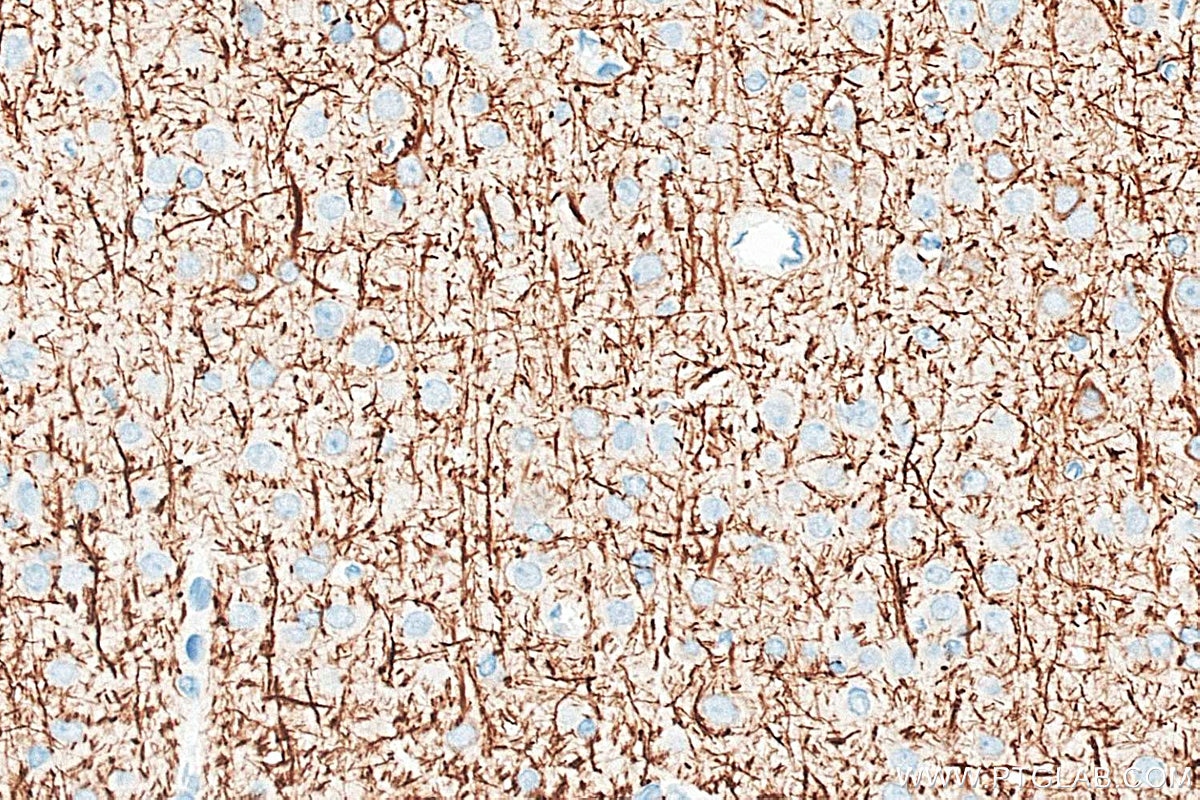 IHC staining of rat brain using 18934-1-AP Immunohistochemistry (IHC) staining of rat brain tissue using NF-H/NF200 Polyclonal antibody (18934-1-AP)