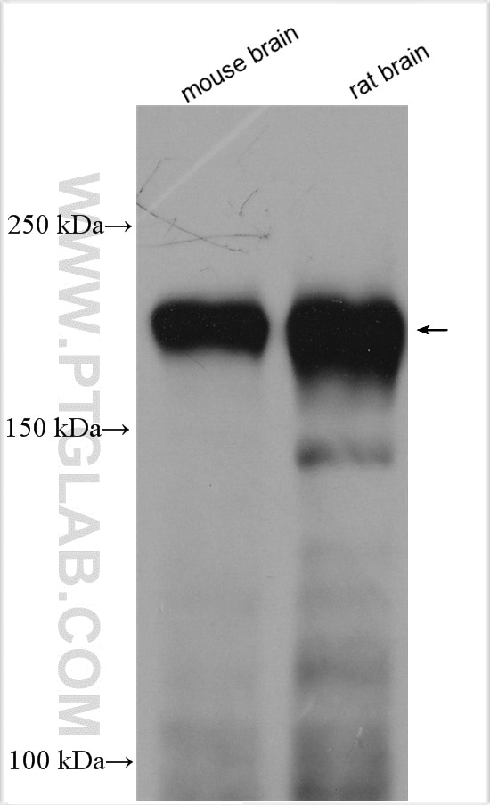 Western Blot (WB) analysis of various lysates using NF-H/NF200 Polyclonal antibody (18934-1-AP)