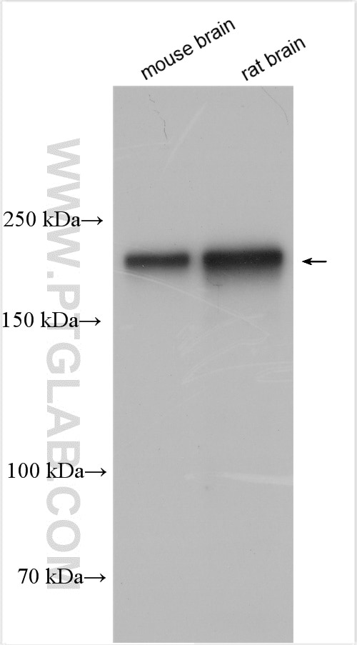 Western Blot (WB) analysis of various lysates using NF-H/NF200 Polyclonal antibody (18934-1-AP)