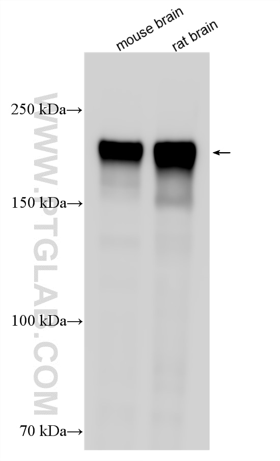 Various lysates were subjected to SDS PAGE followed by western blot with 18934-1-AP (NF-H/NF200 antibody) at dilution of 1:30000 incubated at room temperature for 1.5 hours. Western Blot (WB) analysis of various lysates using NF-H/NF200 Polyclonal antibody (18934-1-AP)