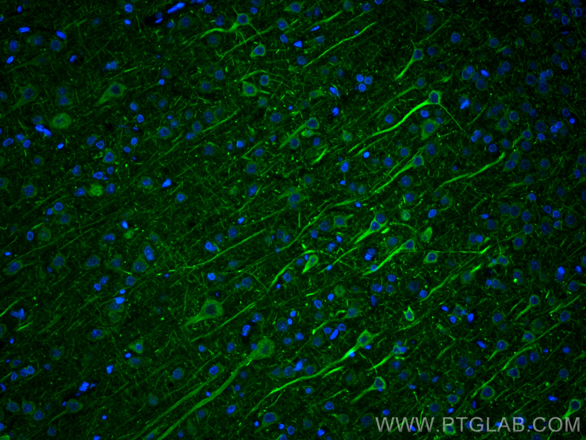 Immunofluorescence (IF) / fluorescent staining of rat brain tissue using NF-H/NF200 Polyclonal antibody (21471-1-AP)