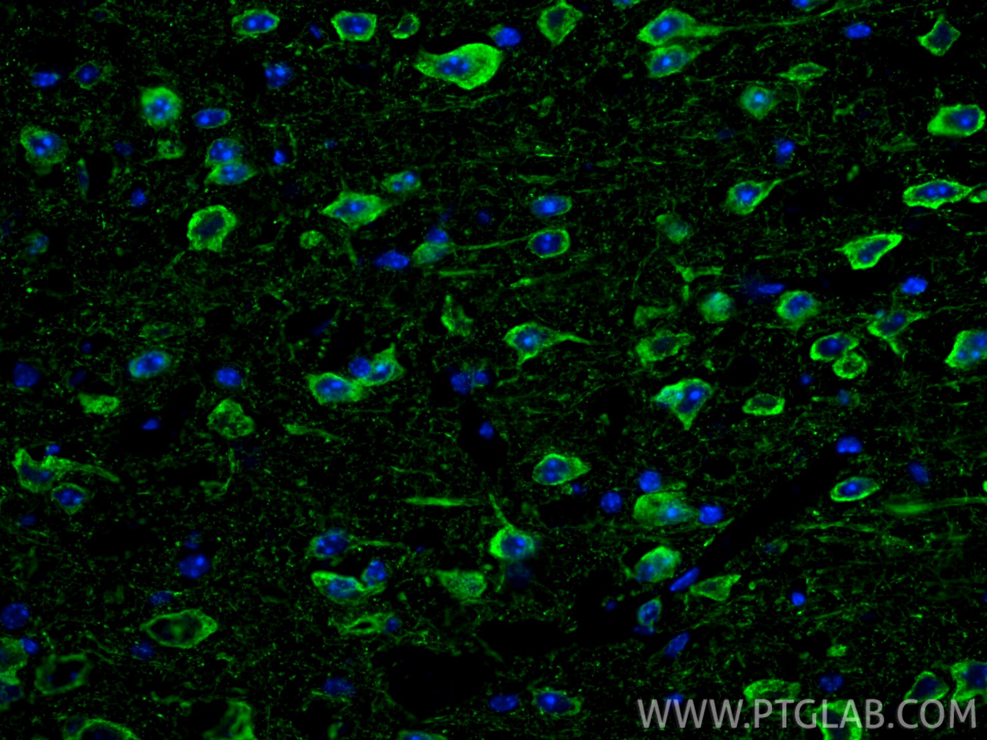 IF Staining of mouse brain using 21471-1-AP Immunofluorescence (IF) / fluorescent staining of mouse brain tissue using NF-H/NF200 Polyclonal antibody (21471-1-AP)