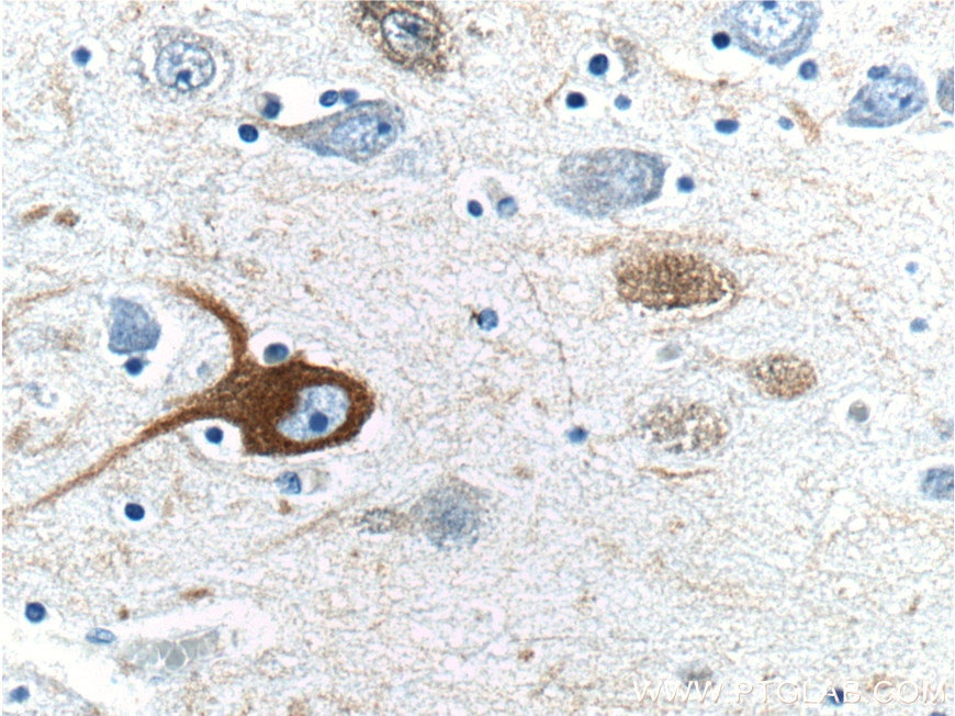 Immunohistochemistry (IHC) staining of human brain tissue using NF-H/NF200 Polyclonal antibody (21471-1-AP)