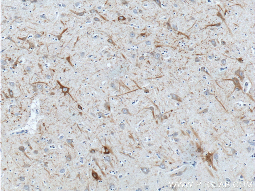 Immunohistochemistry (IHC) staining of human brain tissue using NF-H/NF200 Polyclonal antibody (21471-1-AP)
