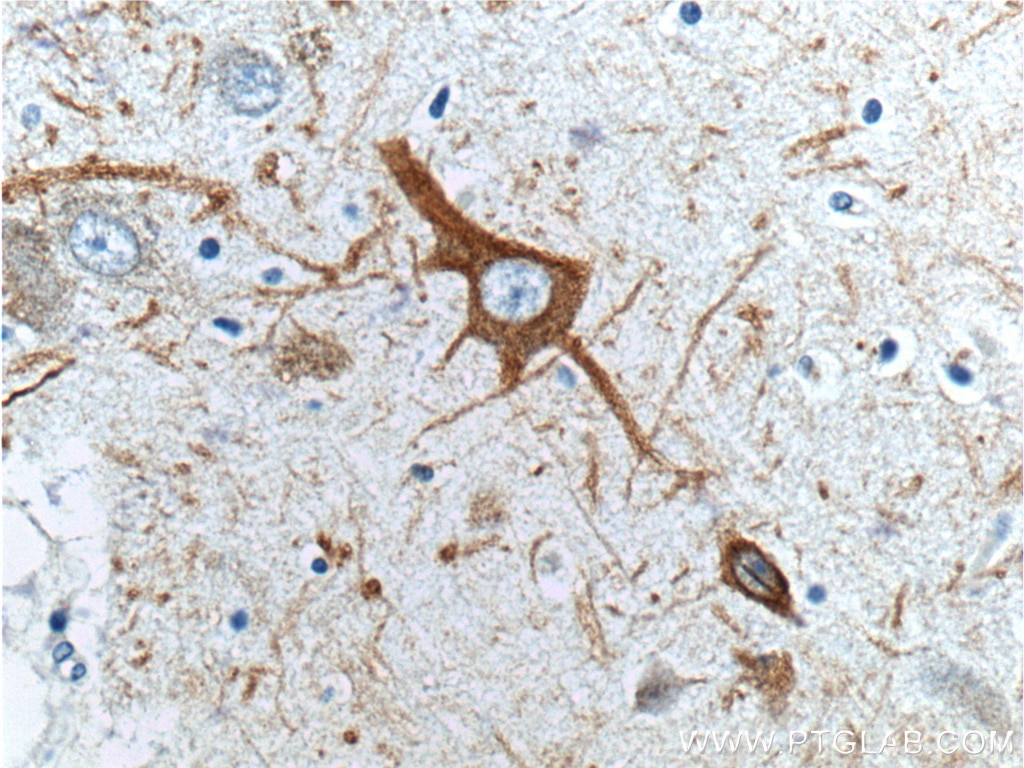 Immunohistochemistry (IHC) staining of human brain tissue using NF-H/NF200 Polyclonal antibody (21471-1-AP)