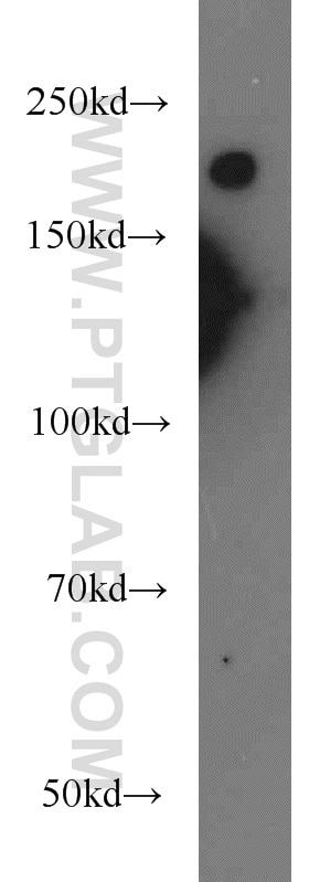 Western Blot (WB) analysis of mouse brain tissue using NF-H/NF200 Polyclonal antibody (21471-1-AP)