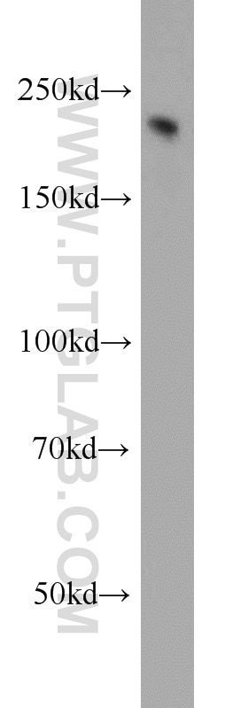 Western Blot (WB) analysis of mouse brain tissue using NF-H/NF200 Polyclonal antibody (21471-1-AP)