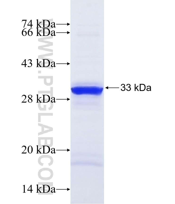 NF200 fusion protein Ag13520 SDS-PAGE