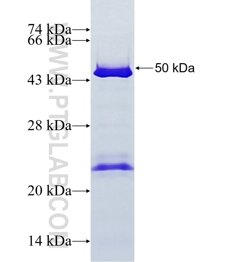 NEFH fusion protein Ag15249 SDS-PAGE