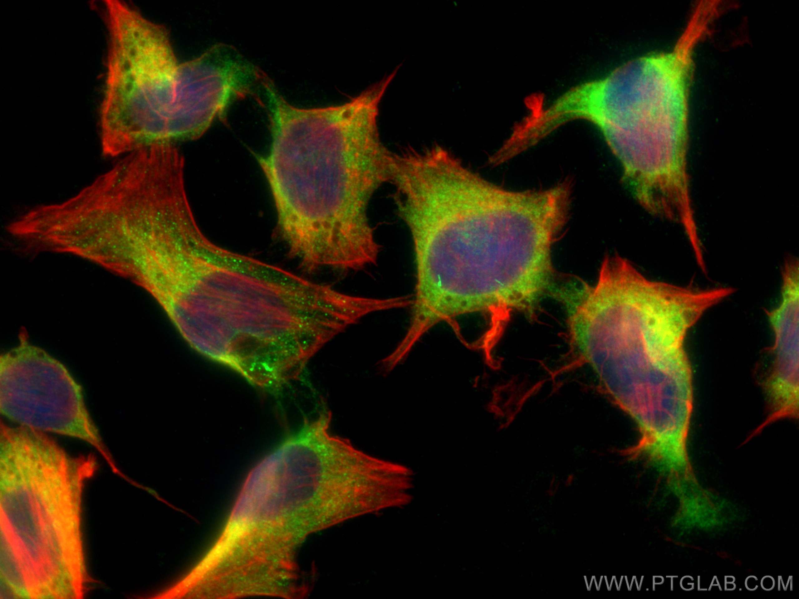Immunofluorescence (IF) / fluorescent staining of SH-SY5Y cells using NF-L Polyclonal antibody (12998-1-AP)