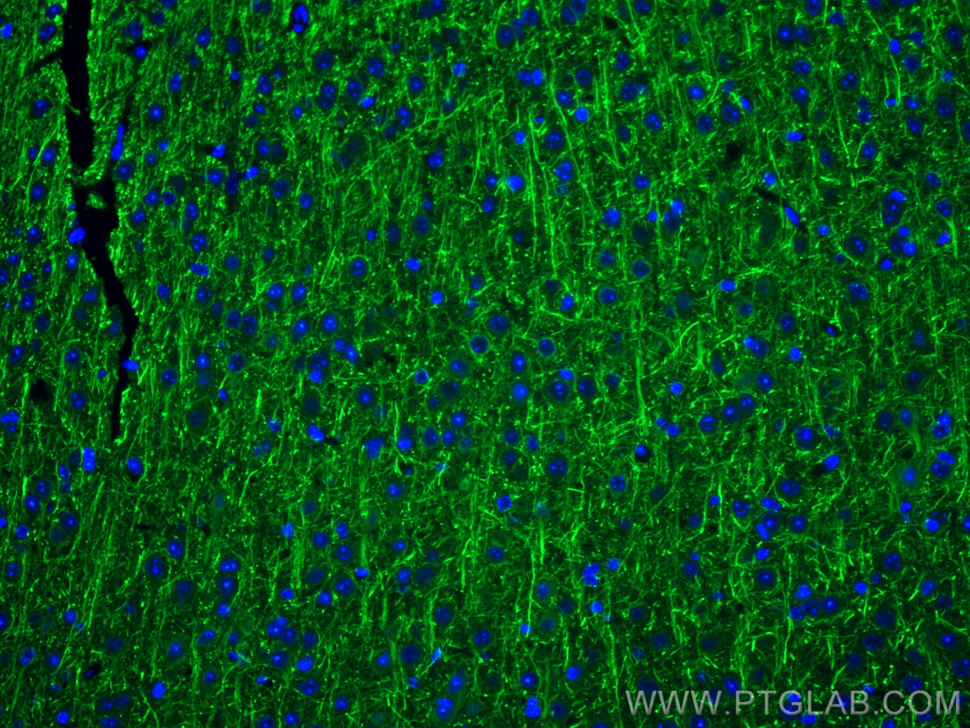 IF Staining of mouse brain using 12998-1-AP