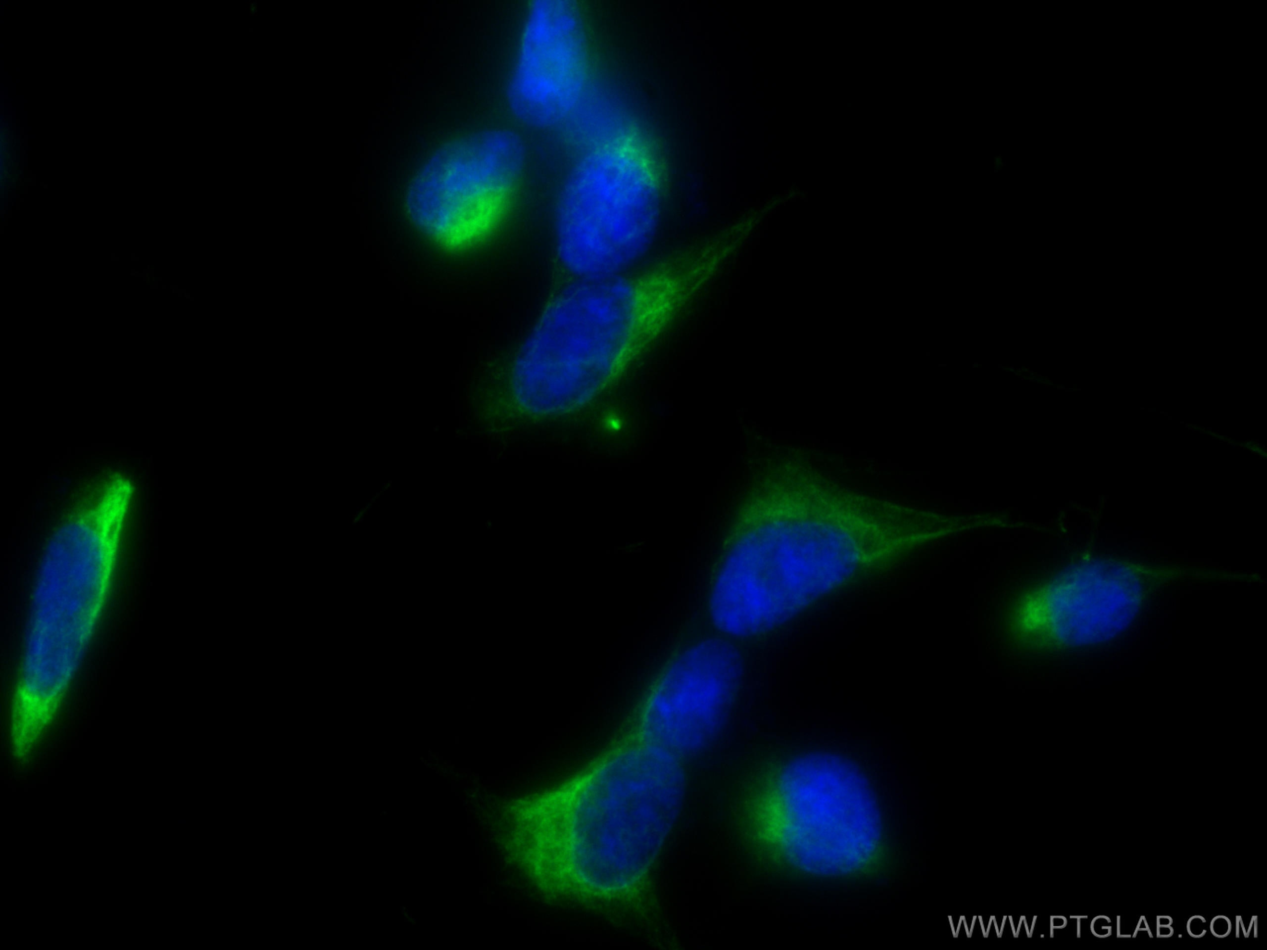 Immunofluorescence (IF) / fluorescent staining of SH-SY5Y cells using NF-L Polyclonal antibody (12998-1-AP)