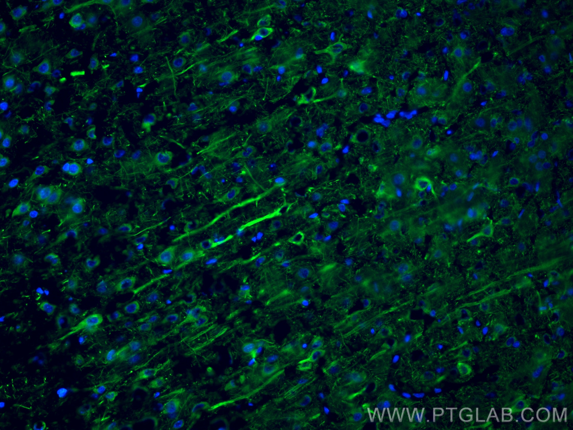 Immunofluorescence (IF) / fluorescent staining of rat brain tissue using NF-L Polyclonal antibody (12998-1-AP)