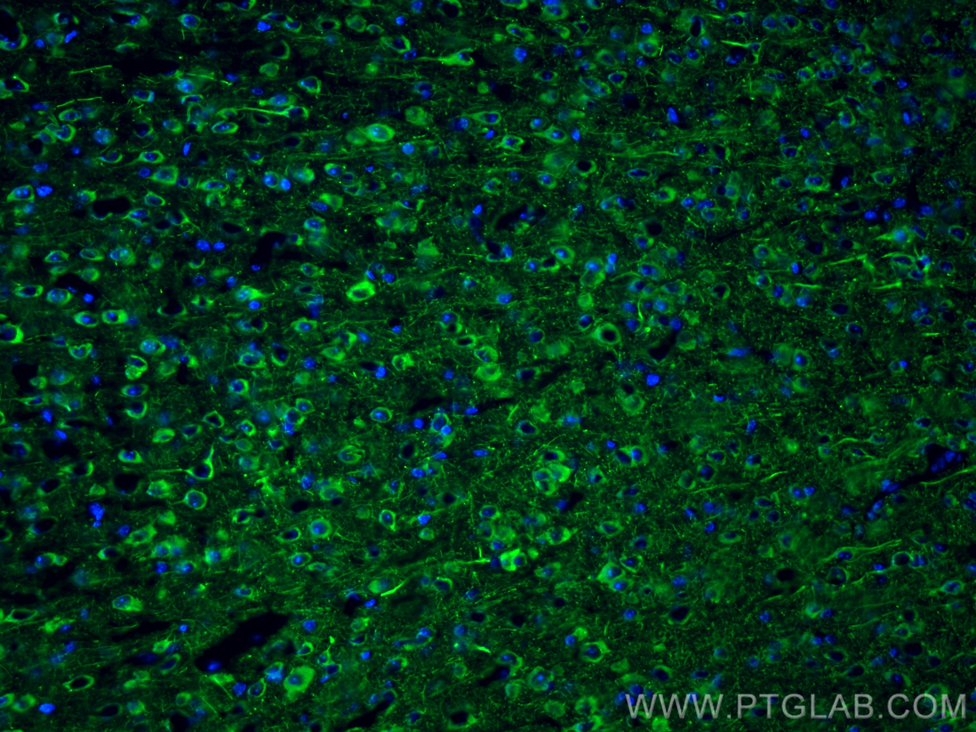 Immunofluorescence (IF) / fluorescent staining of mouse brain tissue using NF-L Polyclonal antibody (12998-1-AP)
