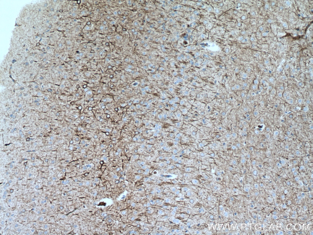 Immunohistochemistry (IHC) staining of mouse brain tissue using NF-L Polyclonal antibody (12998-1-AP)