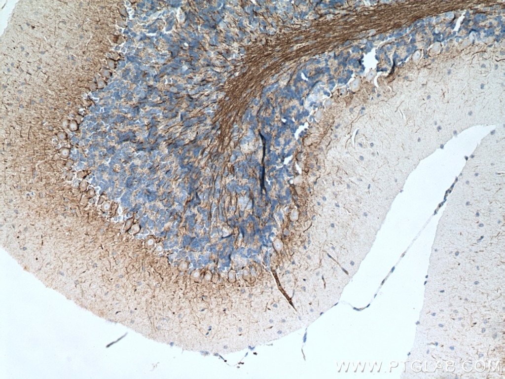 IHC staining of mouse brain using 12998-1-AP