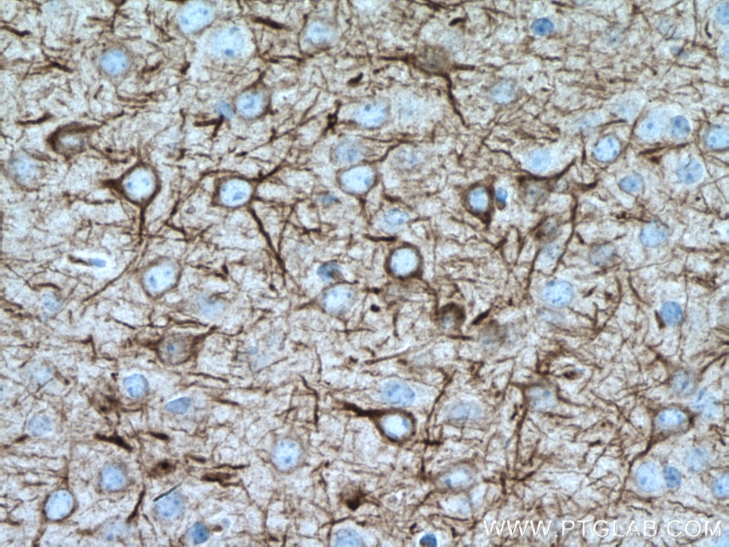 Immunohistochemistry (IHC) staining of mouse brain tissue using NF-L Polyclonal antibody (12998-1-AP)