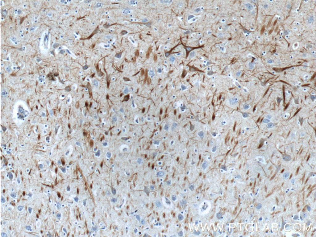 NF-L Polyclonal antibody