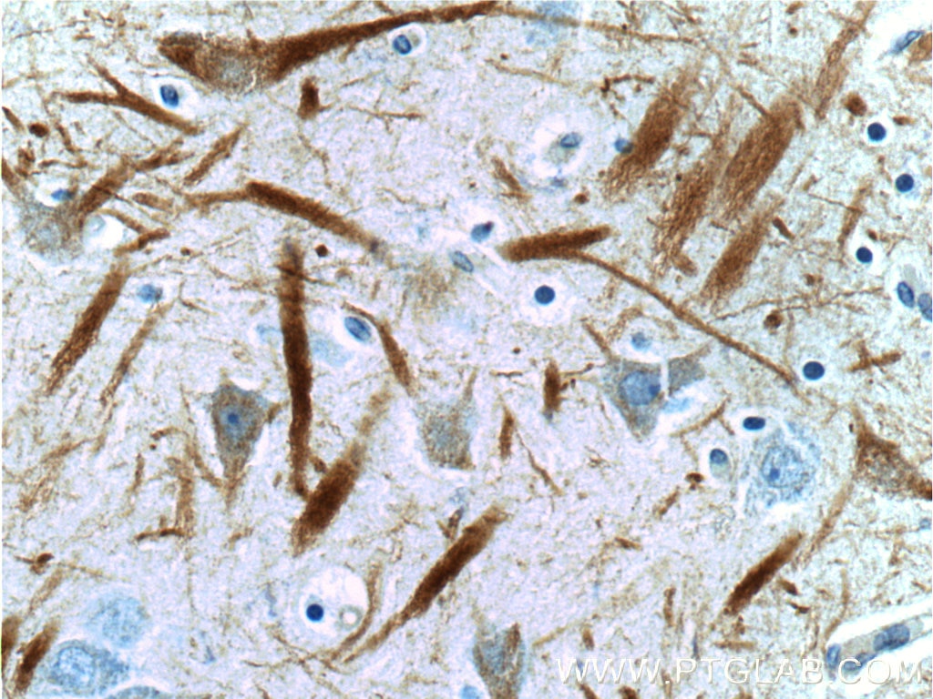 NF-L Polyclonal antibody