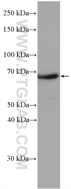 Western Blot (WB) analysis of Neuro-2a cells using NF-L Polyclonal antibody (12998-1-AP)