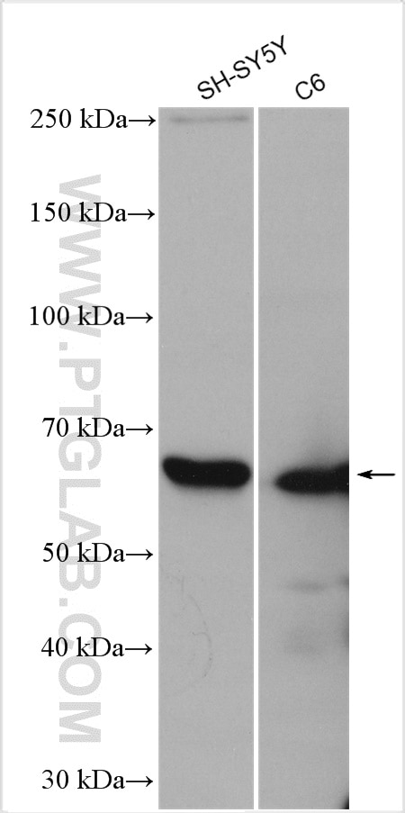 Western Blot (WB) analysis of various lysates using NF-L Polyclonal antibody (12998-1-AP)