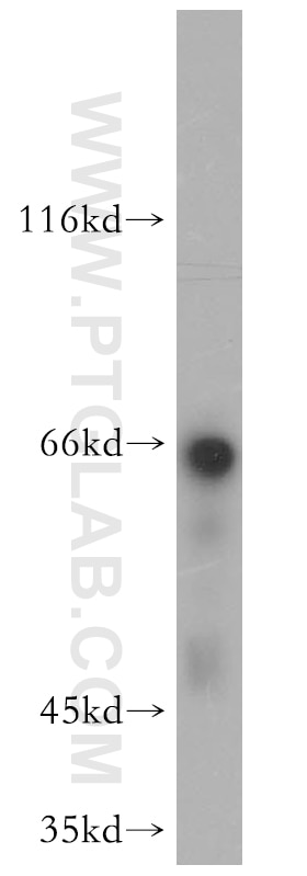 Western Blot (WB) analysis of mouse brain tissue using NF-L Polyclonal antibody (12998-1-AP)