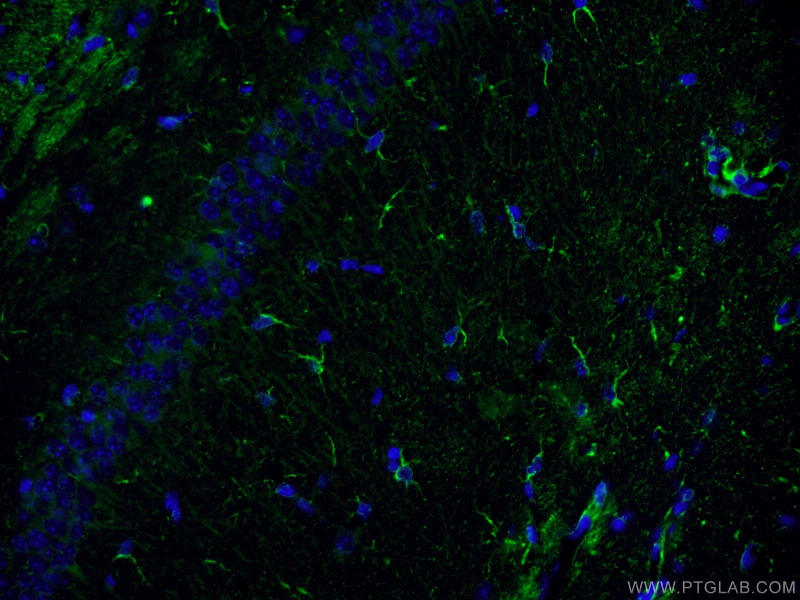 Immunofluorescence (IF) / fluorescent staining of mouse brain tissue using NF-L Monoclonal antibody (60189-1-Ig)