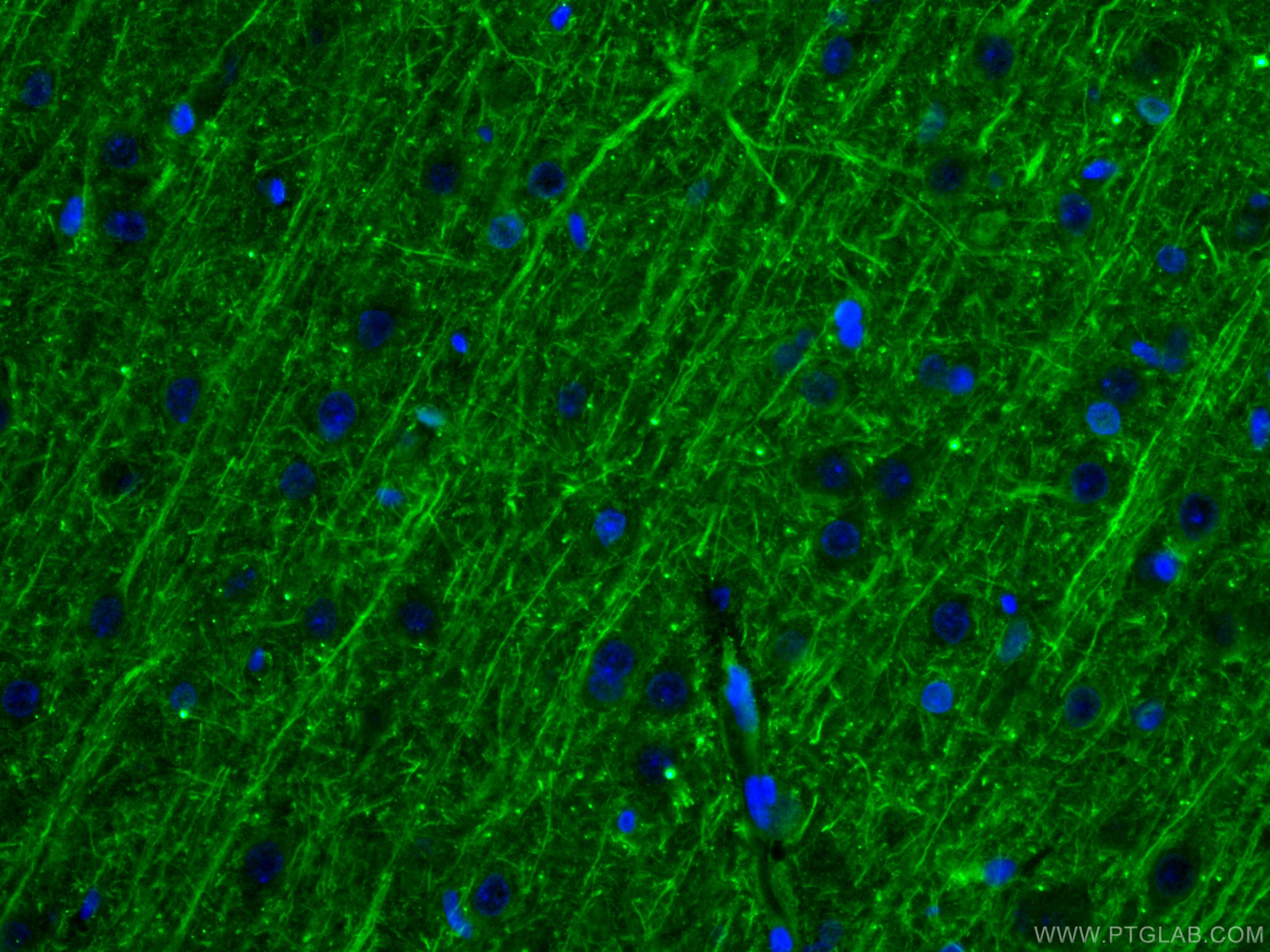 Immunofluorescence (IF) / fluorescent staining of rat brain tissue using NF-L Monoclonal antibody (60189-1-Ig)