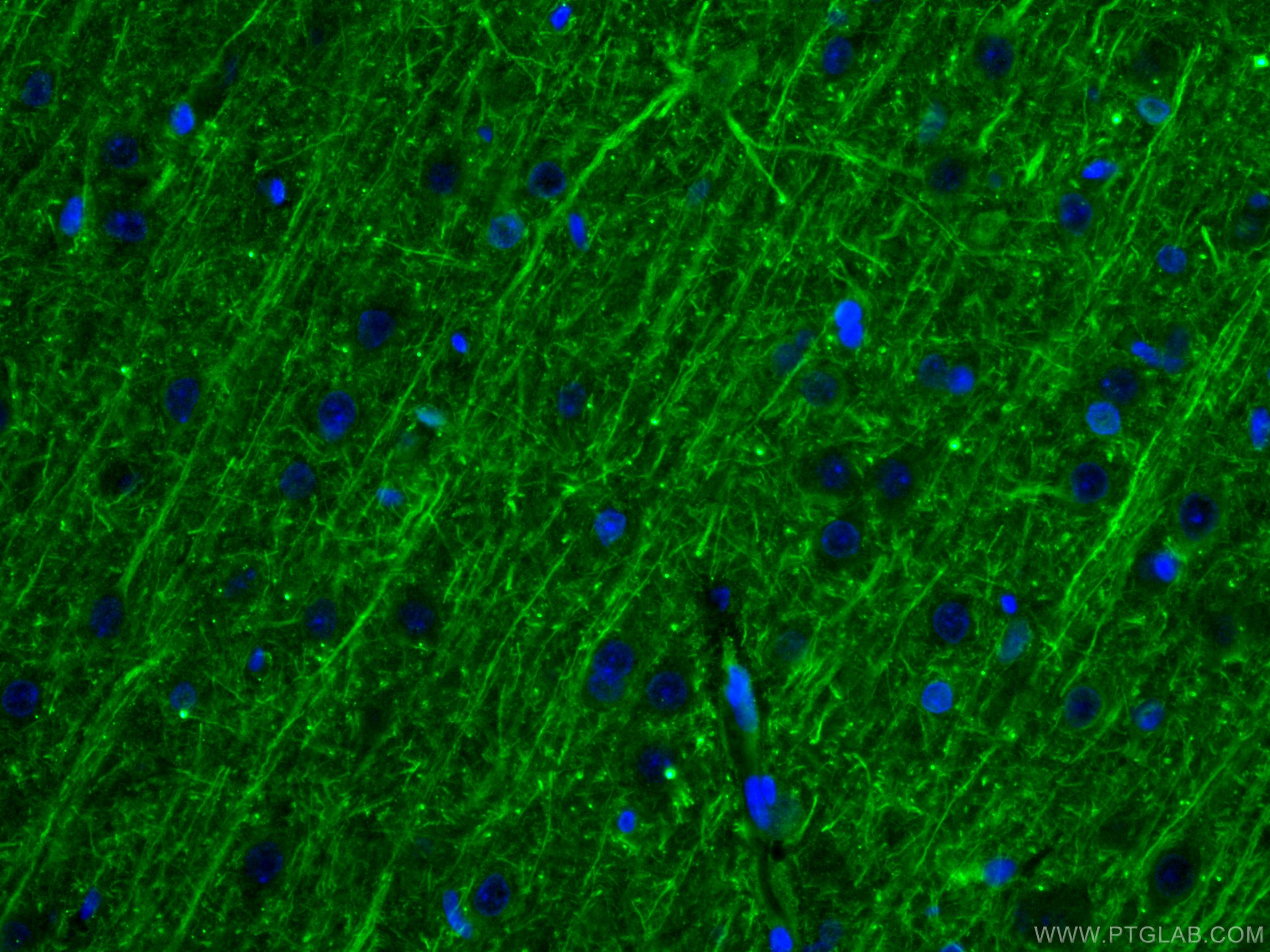 IF Staining of rat brain using 60189-1-Ig