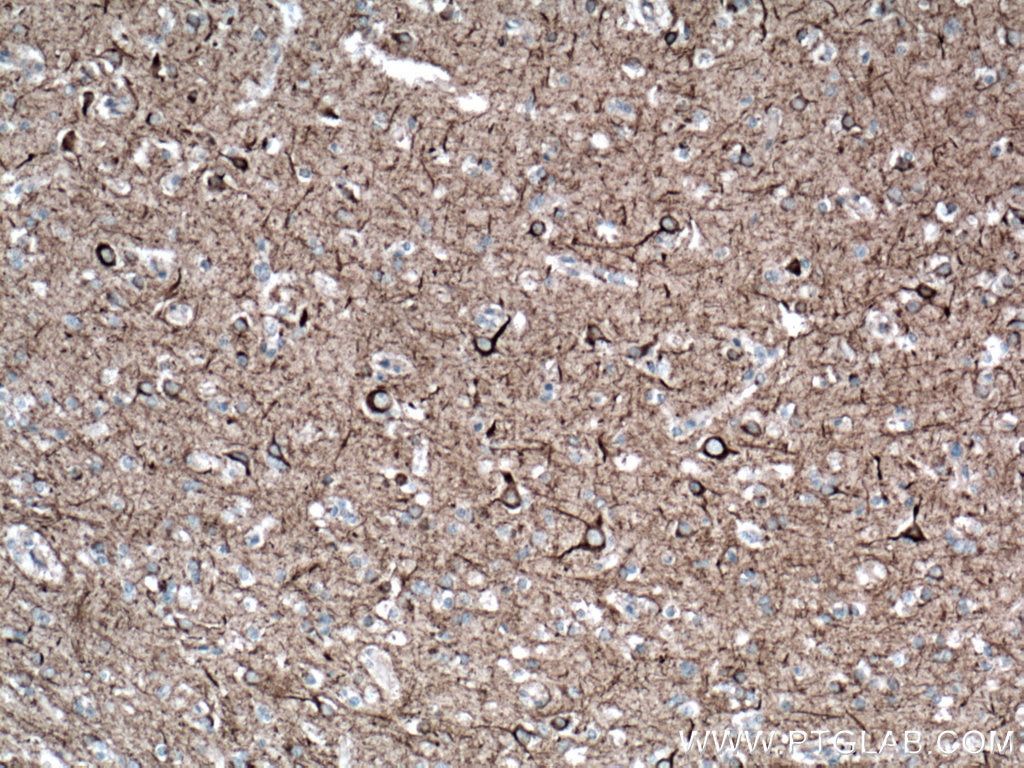 Immunohistochemistry (IHC) staining of human brain tissue using NF-L Monoclonal antibody (60189-1-Ig)