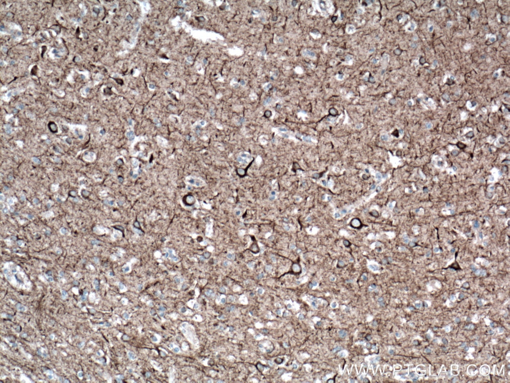 IHC staining of human brain using 60189-1-Ig