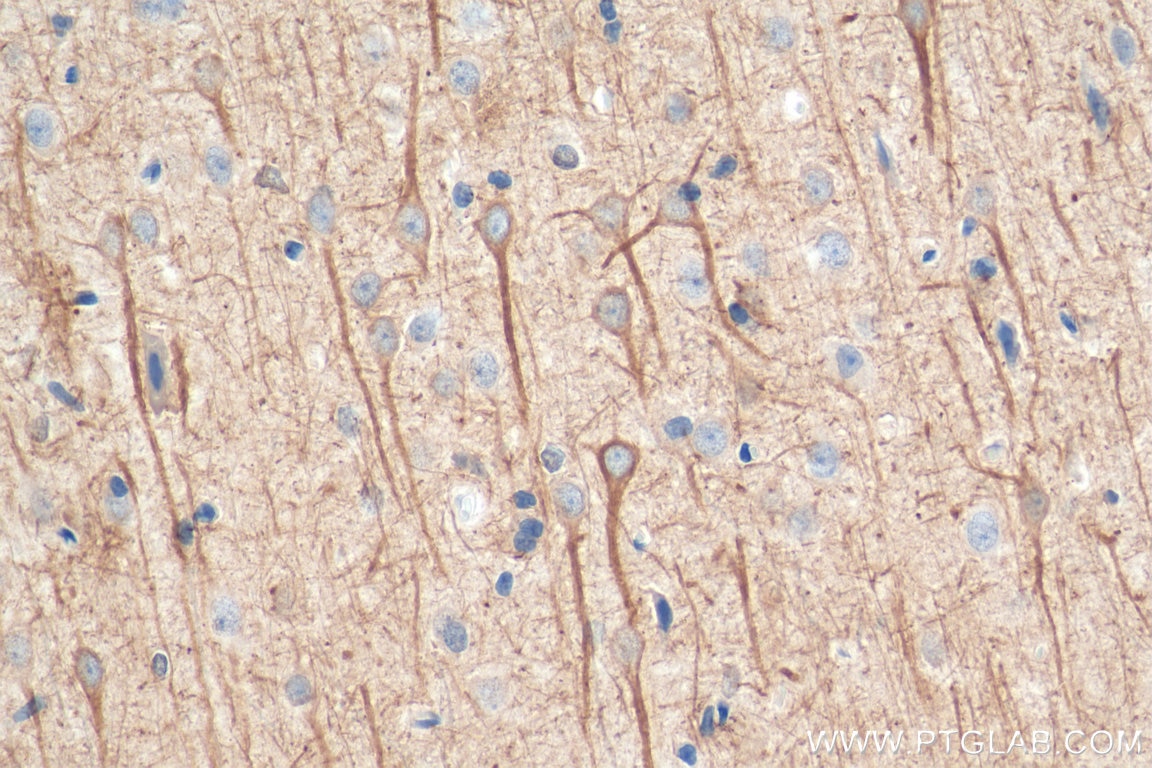 Immunohistochemistry (IHC) staining of rat brain tissue using NF-L Monoclonal antibody (60189-1-Ig)