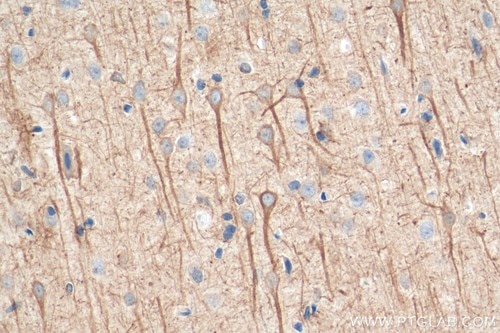 NF-L抗体を使用したマウス脳組織の免疫組織化学染色検証