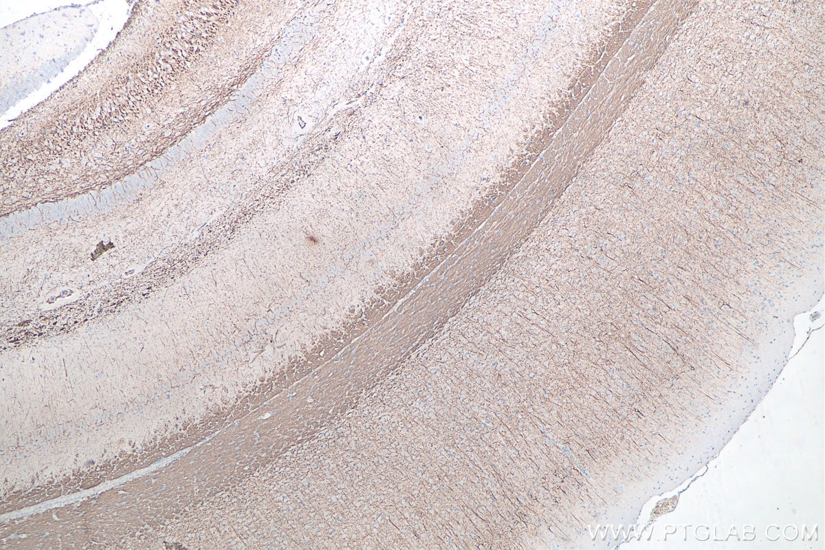 Immunohistochemistry (IHC) staining of rat brain tissue using NF-L Monoclonal antibody (60189-1-Ig)