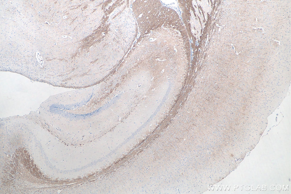 Immunohistochemistry (IHC) staining of mouse brain tissue using NF-L Monoclonal antibody (60189-1-Ig)