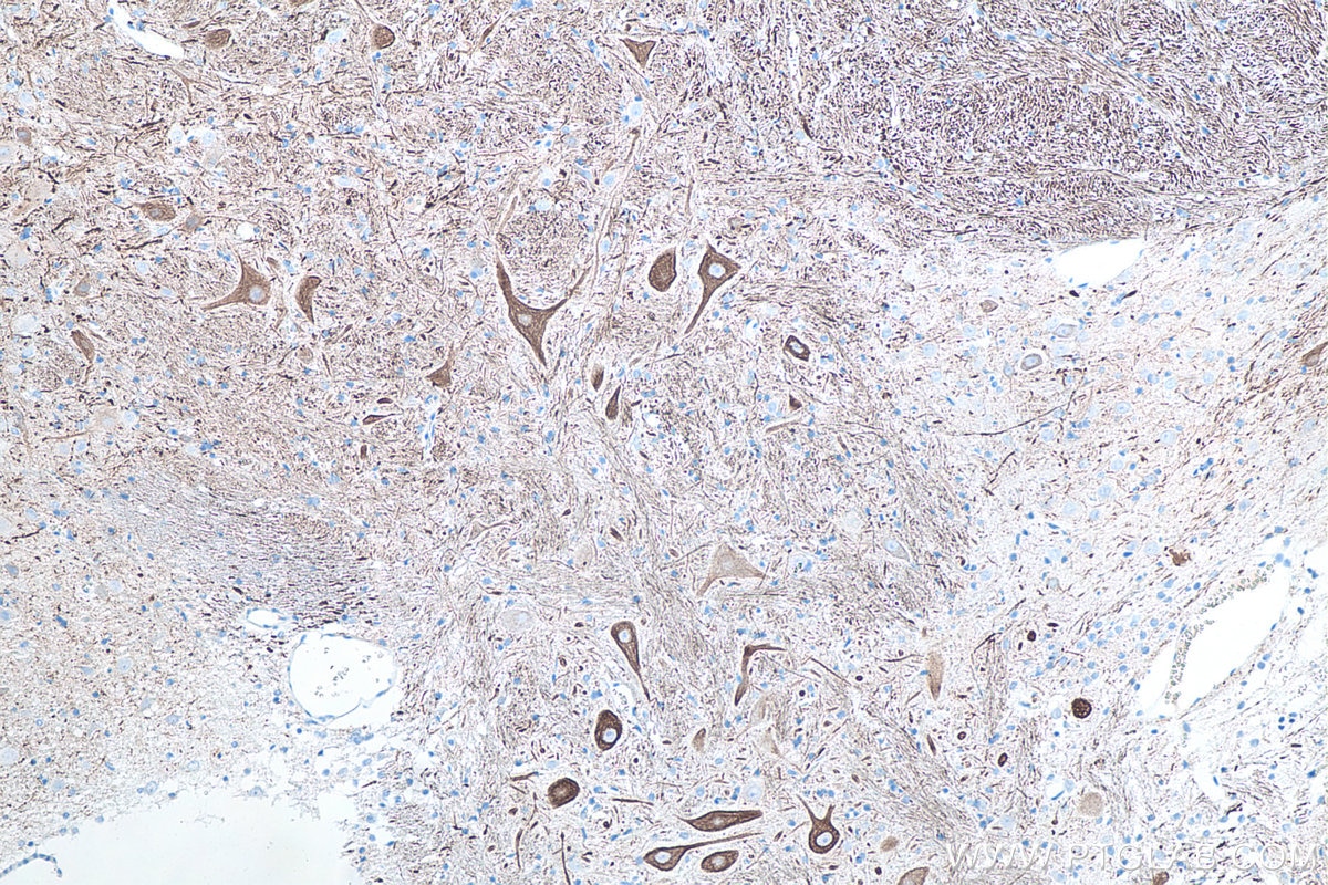 Immunohistochemistry (IHC) staining of rat cerebellum tissue using NF-L Monoclonal antibody (60189-1-Ig)