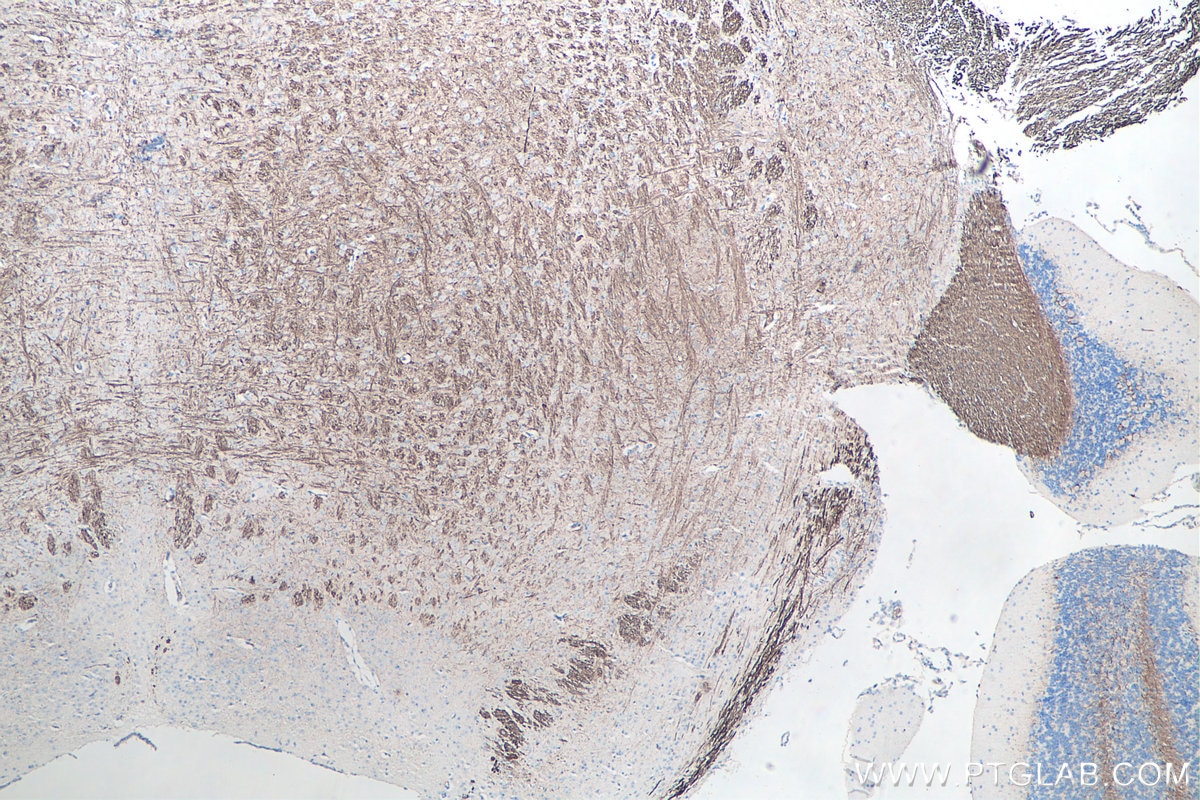 Immunohistochemistry (IHC) staining of mouse cerebellum tissue using NF-L Monoclonal antibody (60189-1-Ig)