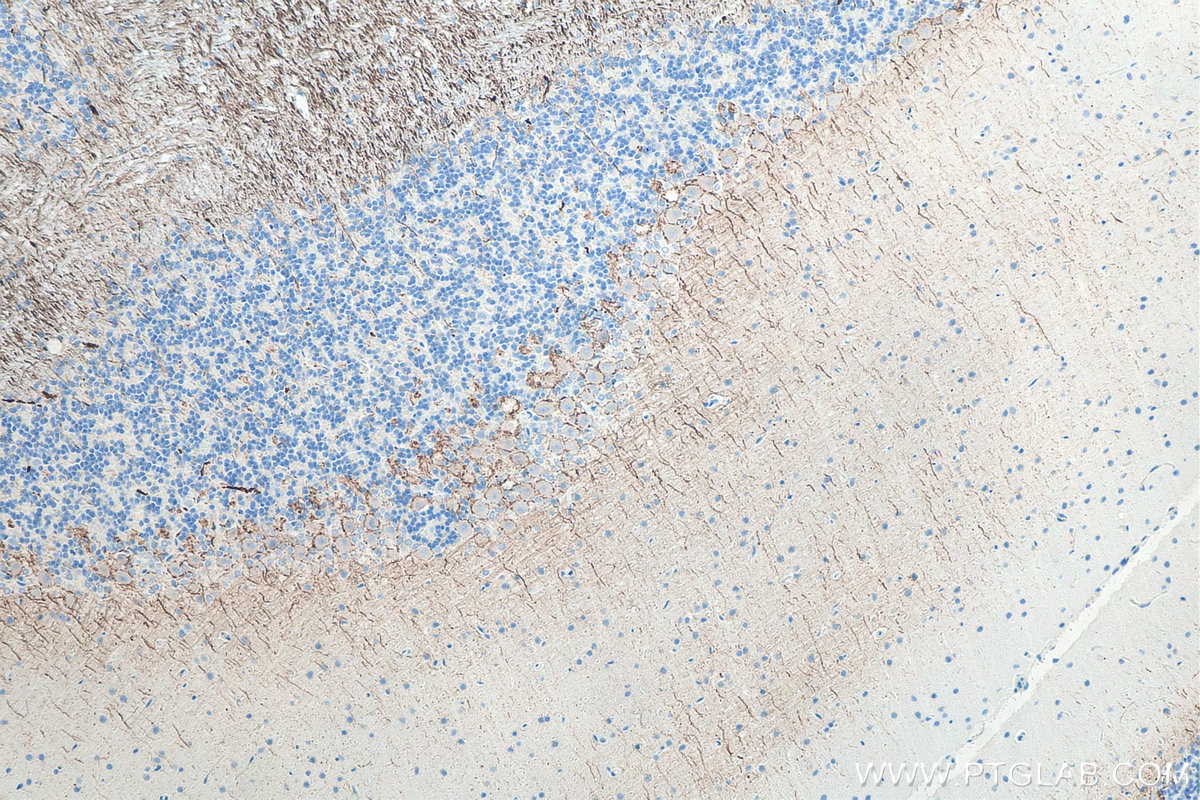 Immunohistochemistry (IHC) staining of rat cerebellum tissue using NF-L Monoclonal antibody (60189-1-Ig)
