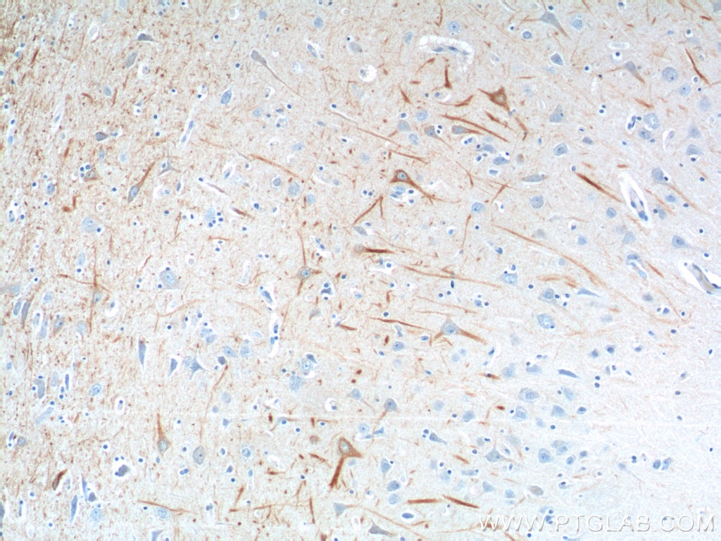 NF-L Monoclonal antibody