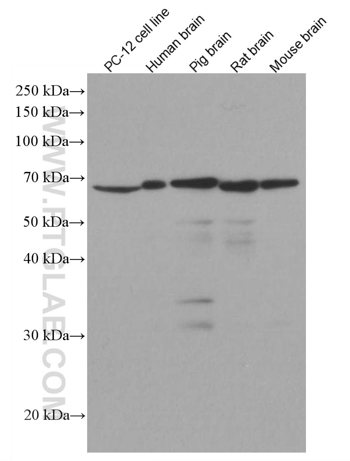 Western Blot (WB) analysis of various lysates using NF-L Monoclonal antibody (60189-1-Ig)