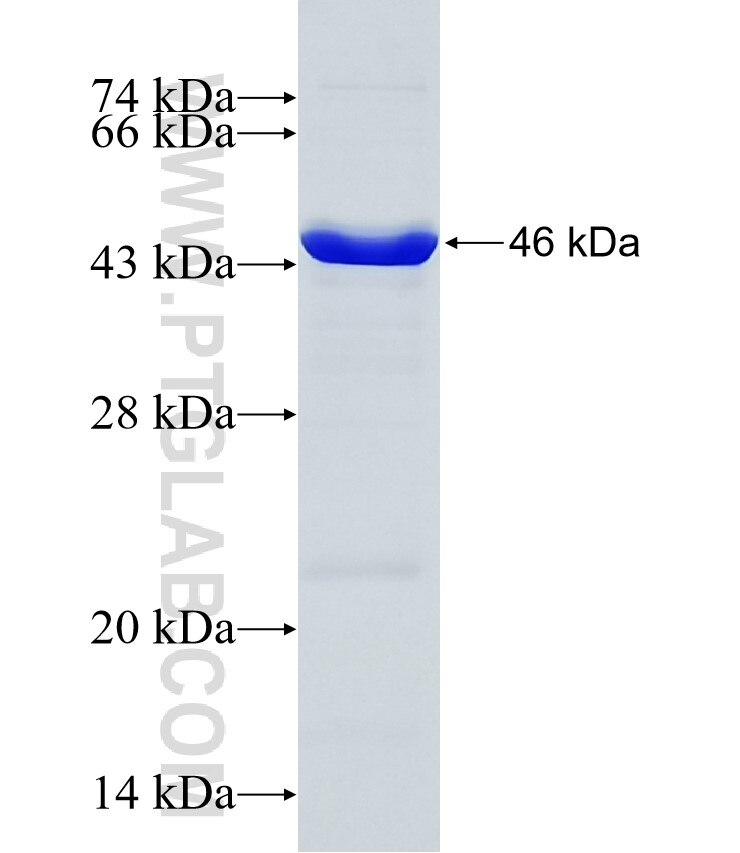 NEFL fusion protein Ag15178 SDS-PAGE