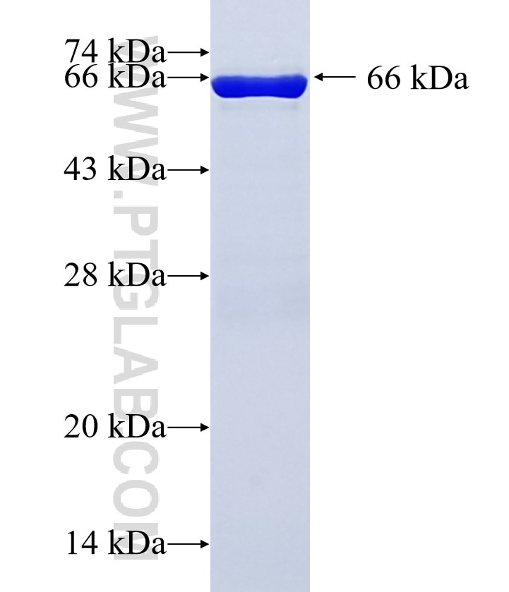 NEFL fusion protein Ag3667 SDS-PAGE