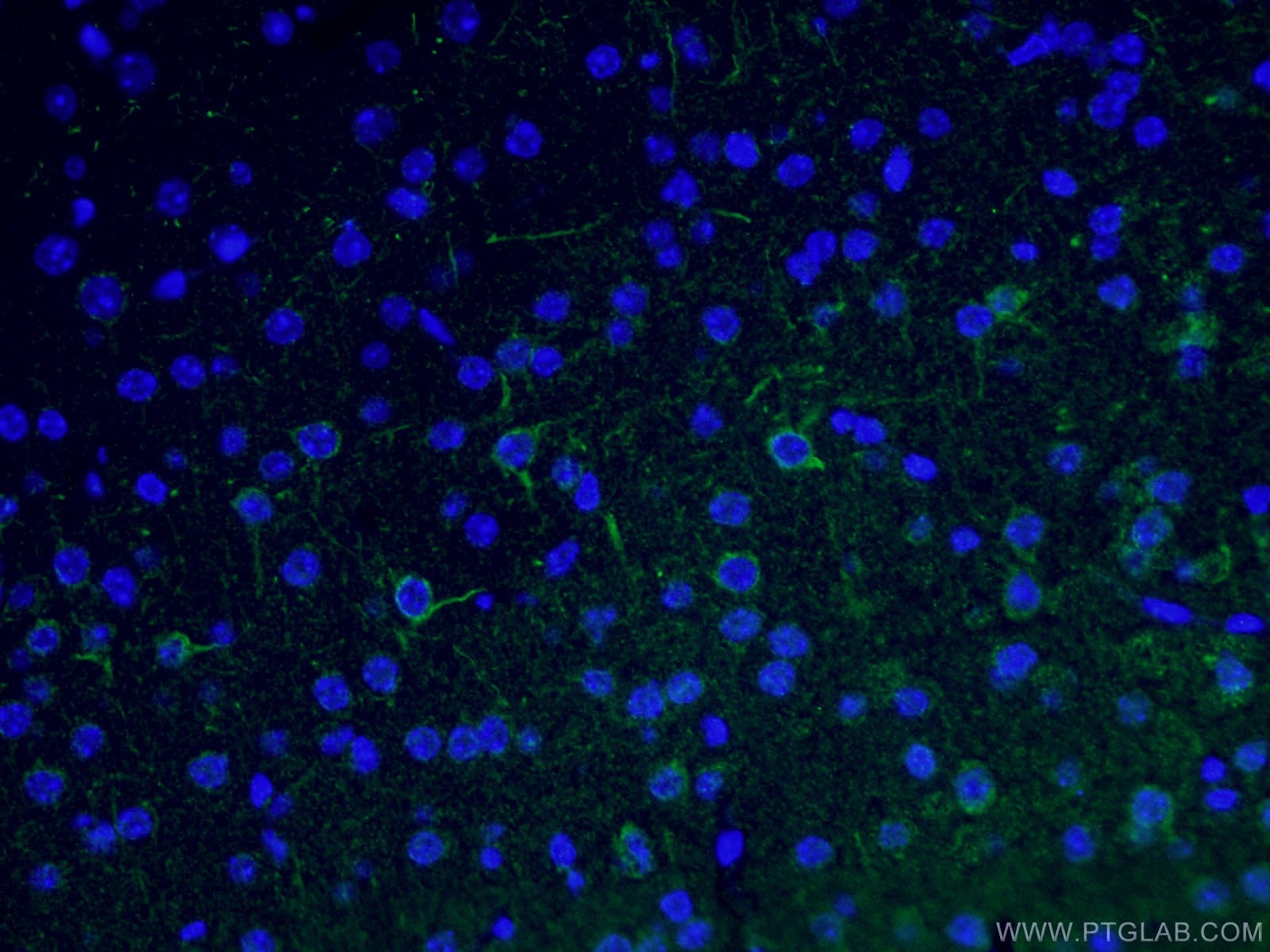 IF Staining of mouse brain using 25805-1-AP