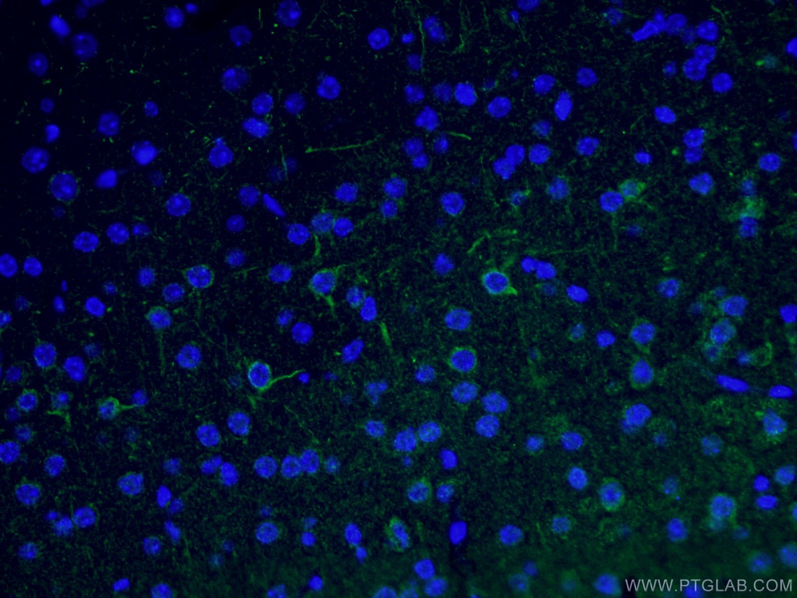 Immunofluorescence (IF) / fluorescent staining of mouse brain tissue using NF-M Polyclonal antibody (25805-1-AP)